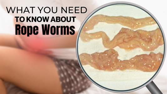 Do You Have Rope Worms? What You Need to Know.
